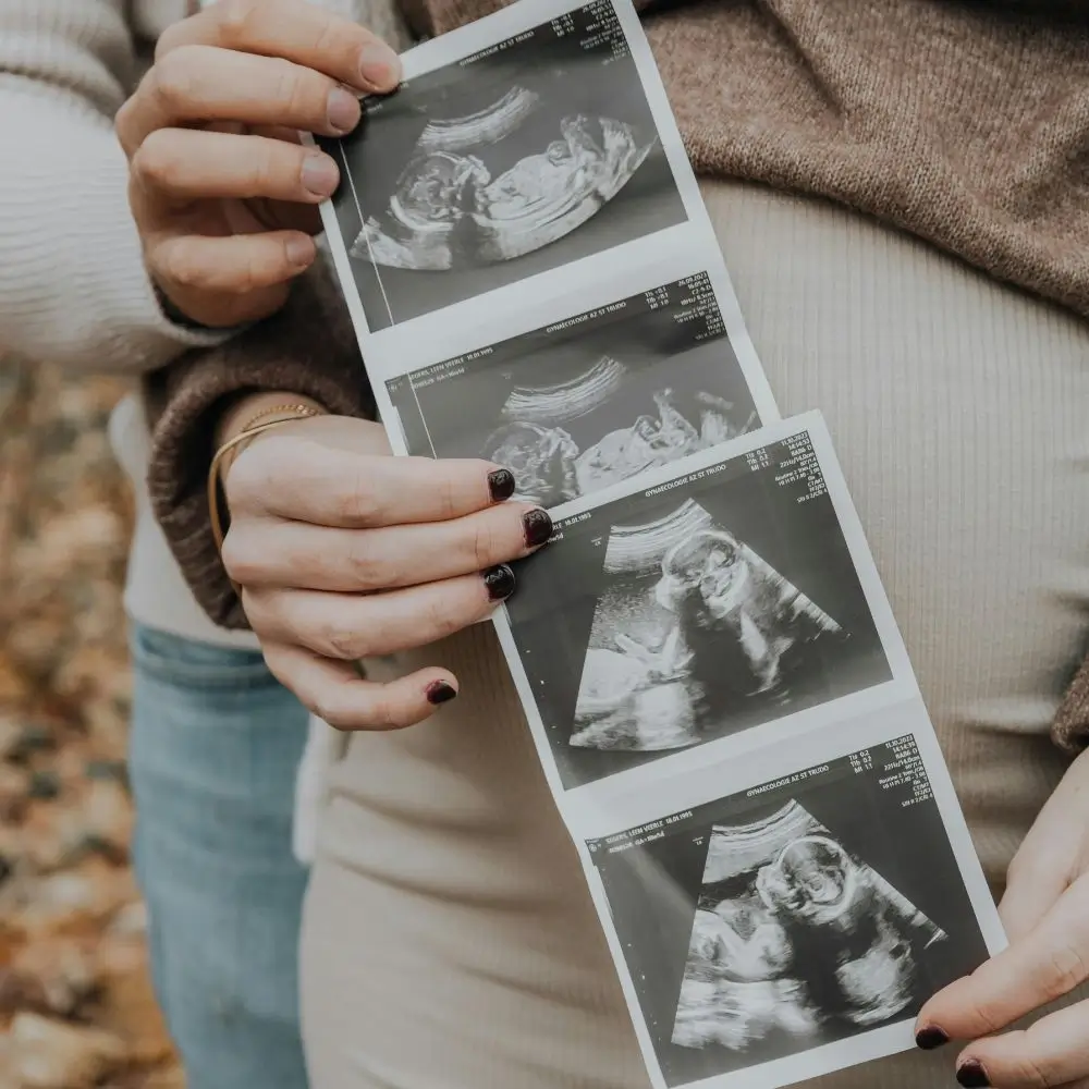Kolkata Maternity Shoots